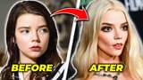 buccal fat removal