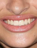 IMG_0206