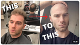 bald