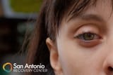 what-drugs-cause-glassy-eyes-san-antonio-recovery-center