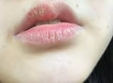 images (20)