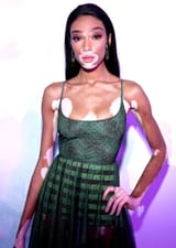 Winnie Harlow