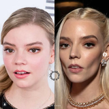 Screenshot 2025-07-20 at 04-53-13 PROBLEMATIC FAME anya taylor-joy then now ( reminder! my posts are not meant to accuse anyone of having any cosmetic procedures or insinuate such. i’m... Instagram