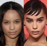 zoe-kravtiz-plastic-surgery1-1