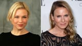 renee zellweger before after