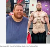 loose skin
