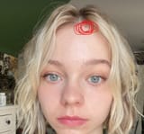 head nipple