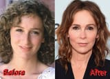 Jennifer-Grey-Nose-Job-Transformation2-2527592846