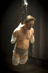 american-mary-amputation