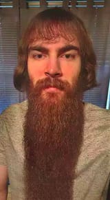 man on reddit who used to have an absurd medieval peasant beard + haircut combo 1