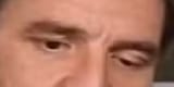eye down