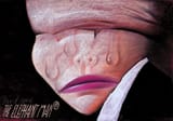elephant man