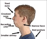 mouth-breathing-face