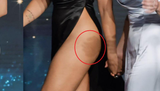 a scar