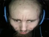 raxx