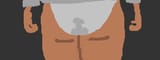 hemorrhoids