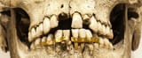 Ancient-Egyptians-preferred-gold-orthodontics-dentures_0_0