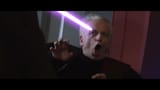 palps