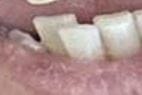 teeth aeghr