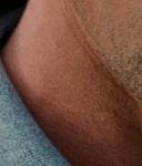 bane vein