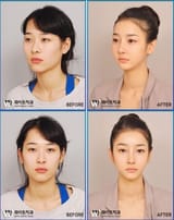 korea