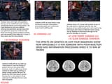 EFFECTS OF BRAIN DEVELOPMENT ON TEKKEN GAMEPLAY