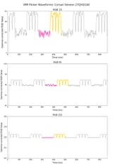 vrr-flicker-graph-picture-medium