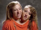 abby-brittany-hensel