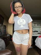7657564