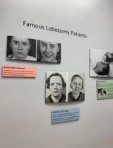 famous-lobotomy-patients-glore-psychiatric-museum-v0-cmaacqiqjppe1