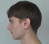 lol