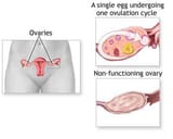 ovaries