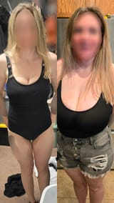 1000336728