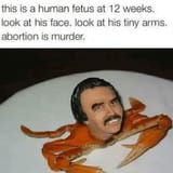 human fetus