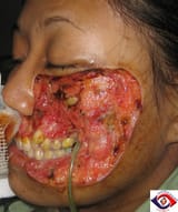 Woman_face_disease