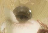 eye_of_miquella