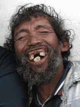dentes