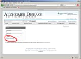 alzheimers