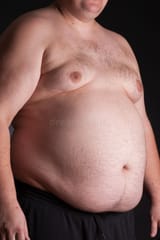 obese-young-man-shirt-48675321