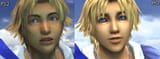 veins vs melting iris