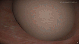 1736656300638149