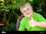 close-up-portrait-of-cute-handicapped-boy-showing-thumbs-up-outside-E0T440