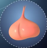 pituitary