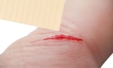 papercut