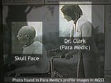 mgsv_skullface_drclark