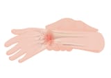 Wrist_pain