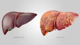 liver