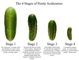 acidization