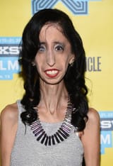 lizzie-velasquez