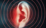 tinnitus
